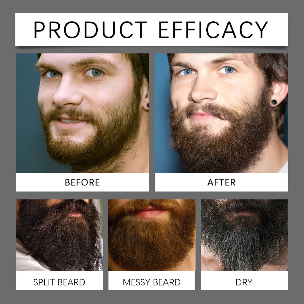 Beard Growth Oil Thickening Serum Promotes Whisker Growth Strengthen Roots Softens Beard Moisturizing Hydrating Men Grooming