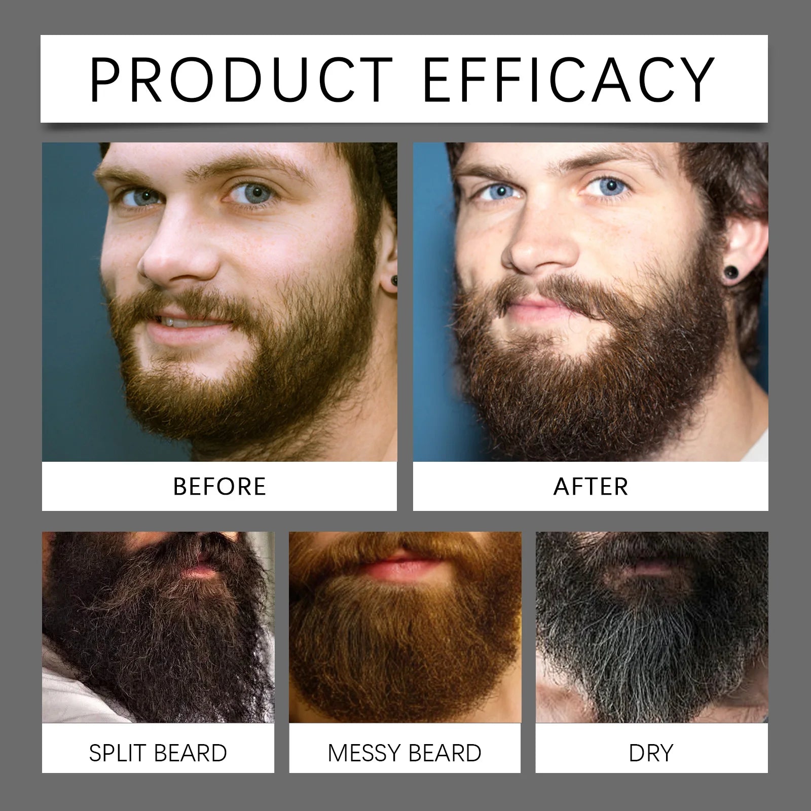 Beard Growth Oil Thickening Serum Promotes Whisker Growth Strengthen Roots Softens Beard Moisturizing Hydrating Men Grooming